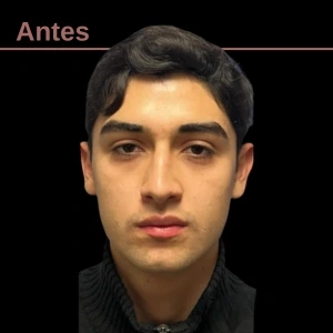 Otorrinolaringología en Guadalajara