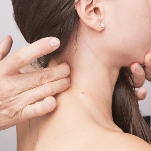 lipoma Cirugía de Lipoma Cervical en Zapopan